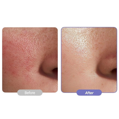 Purito Purito Krem regenerujący Dermide Relief Barrier Moisturizer - 100 ml