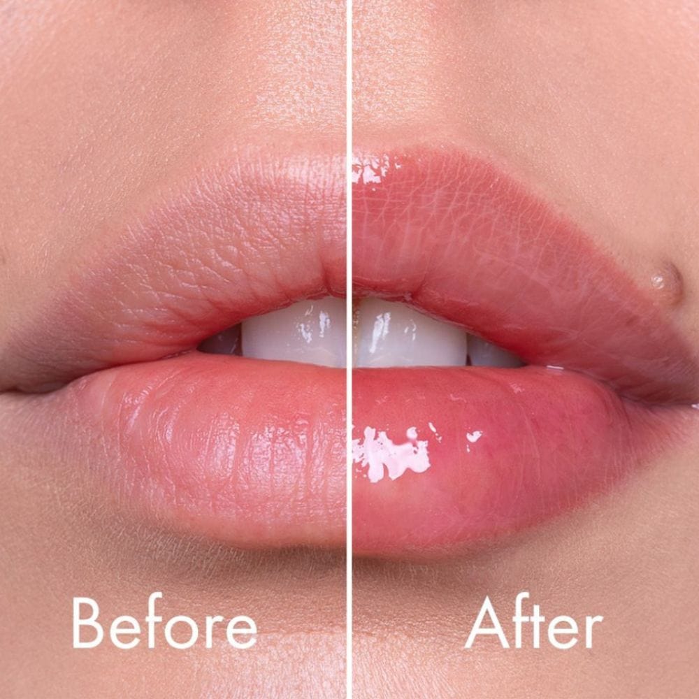 VT Cosmetics VT Cosmetics Reedle Shot Booster powiększający usta - 4,3 g