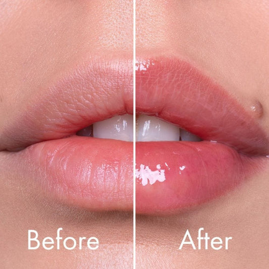 VT Cosmetics VT Cosmetics Reedle Shot Booster powiększający usta - 4,3 g